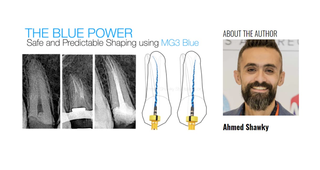 The Blue Power: Safe and predictable shaping with MG3 BLUE