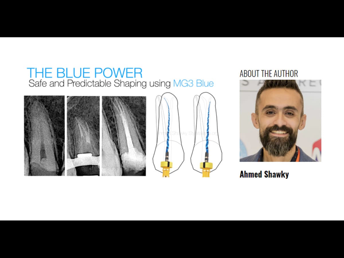 The Blue Power: Safe and predictable shaping with MG3 BLUE